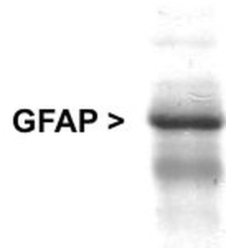GFAP Antibody