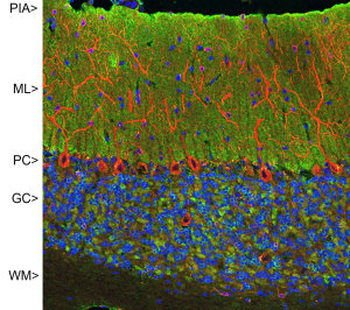 MAP2 (Microtubule assoc. protein 2) Antibody