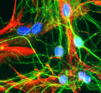 MAP2 (Microtubule assoc. protein 2) Antibody