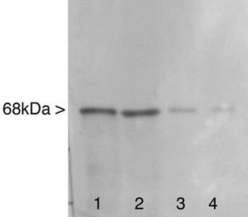 Neurofilament NF-L Antibody