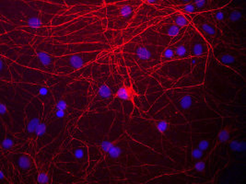 Neurofilament NF-M Antibody