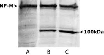Neurofilament NF-M Antibody