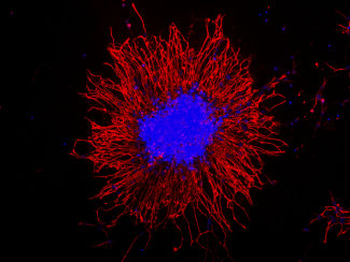 Vimentin Antibody