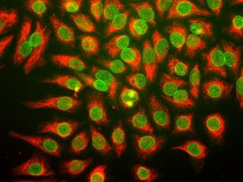 Vimentin Antibody