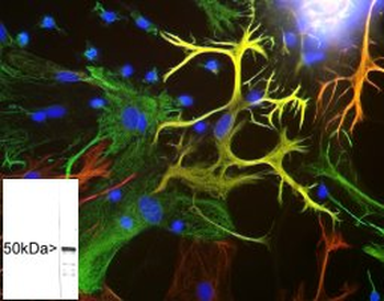 Vimentin Antibody