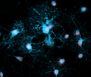 Myelin Basic Protein Antibody