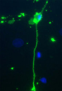 Myelin Basic Protein Antibody