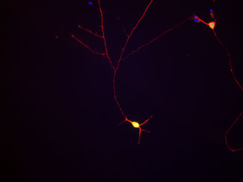 Tau /MAPT+ Antibody