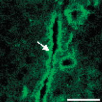 CD39 Antibody