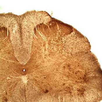 Mu Opioid Receptor Antibody