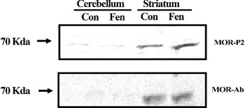 Mu Opioid Receptor Antibody