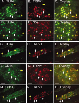 VR1 C-terminus (TRPV1) Antibody
