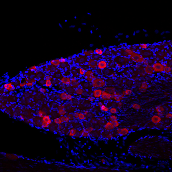 VR1 C-terminus (TRPV1) Antibody
