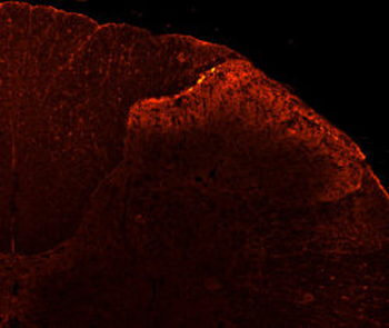 VR1 C-terminus (TRPV1) Antibody