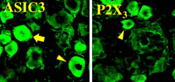 ASIC 3 Antibody