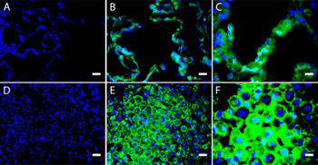 ASIC 3 Antibody