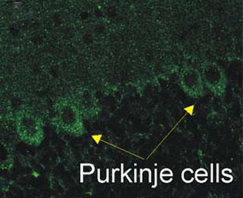 P2X2 Antibody