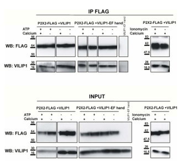 P2X2 Antibody
