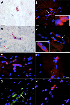 Tyrosine Hydroxylase Antibody