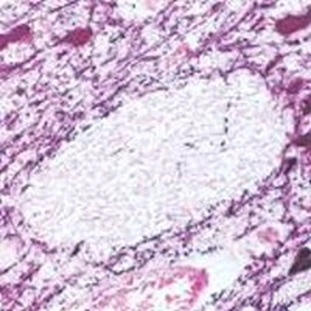Tyrosine Hydroxylase Antibody