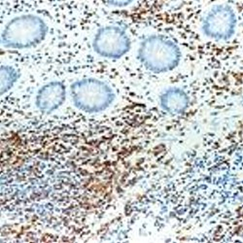 CD43 (Clone MT1) Antibody