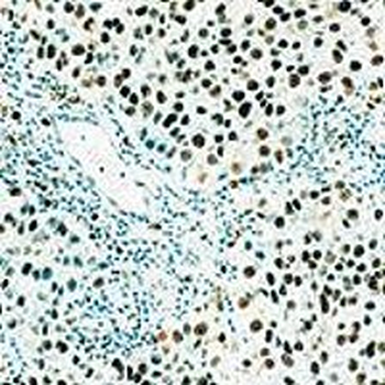 PCNA Antibody