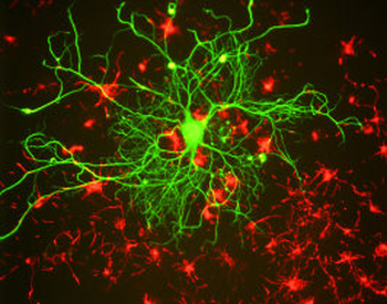 Neurofilament NF-L Antibody