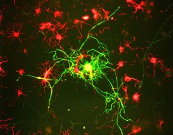 Neurofilament NF-M Antibody
