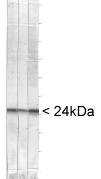 PGP9.5/UCHL1 Antibody