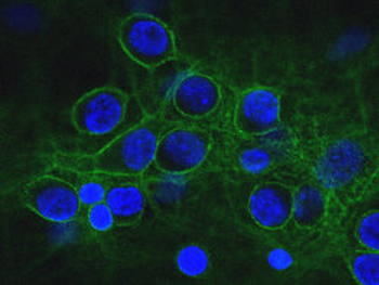 alpha-II-spectrin/alpha-Fodrin Antibody