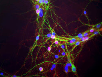 alpha Synuclein Antibody