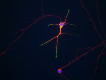 Doublecortin/DCX Antibody