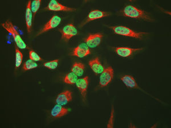 TAF15 Antibody