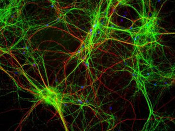 MAP2 (Microtubule assoc. protein 2) Antibody