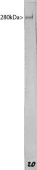 MAP2 (Microtubule assoc. protein 2) Antibody