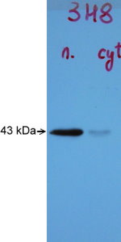 Tar DNA Binding Protein 43 (TDP43) Antibody