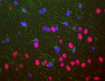 Tar DNA Binding Protein 43 (TDP43) Antibody