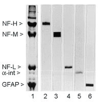 Neurofilament NF-H Antibody