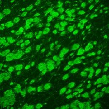 Myelin Basic Protein Antibody
