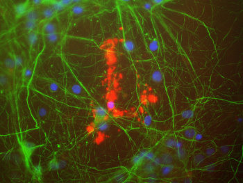 Myelin Basic Protein Antibody