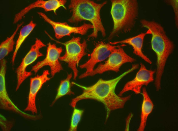 HSP27/HSBP1 Antibody
