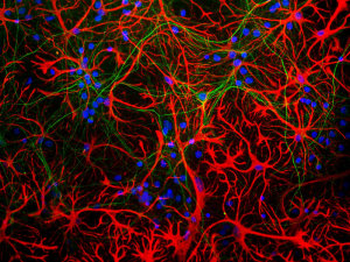 GFAP Antibody
