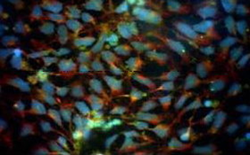 Human Glial-Derived Neurotrophic Factor protein