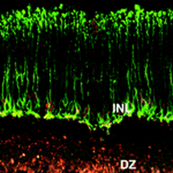 mGluR6 Antibody