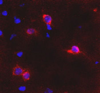 mGluR6 Antibody
