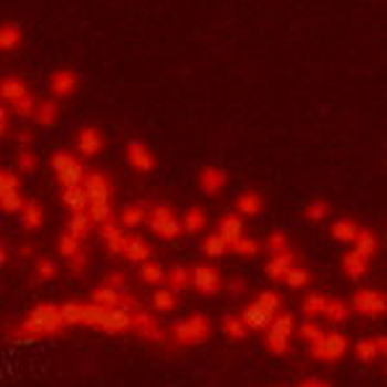 mGluR6 Antibody