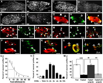 NPY Y2 Receptor Antibody