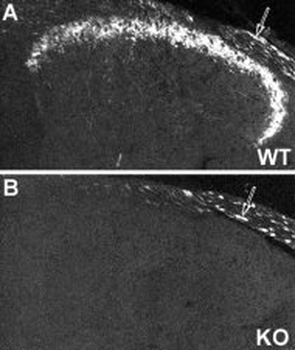 NPY Y2 Receptor Antibody