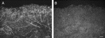 TRPA1 Antibody