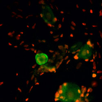 TRPA1 Antibody